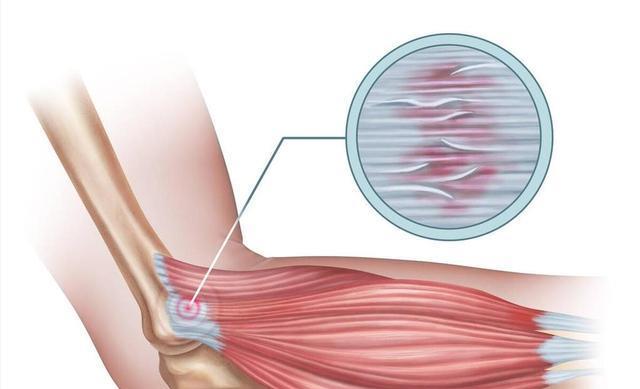 我们才能更, 特别是在用